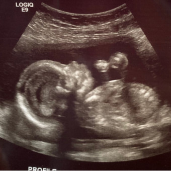 Babylist Registry Photo.