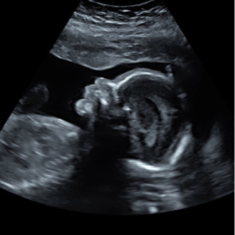 Babylist Registry Photo.