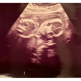 Babylist Registry Photo.