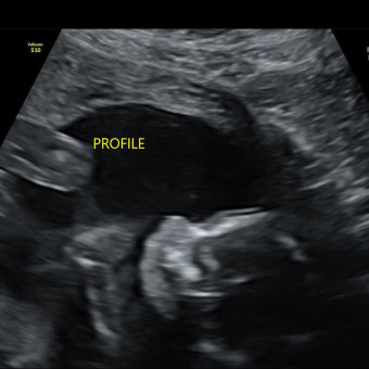 Babylist Registry Photo.