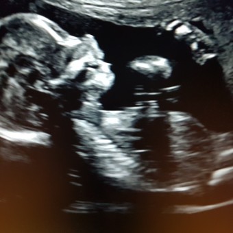 Babylist Registry Photo.