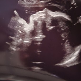Babylist Registry Photo.