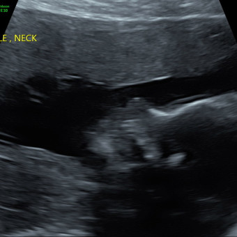 Babylist Registry Photo.