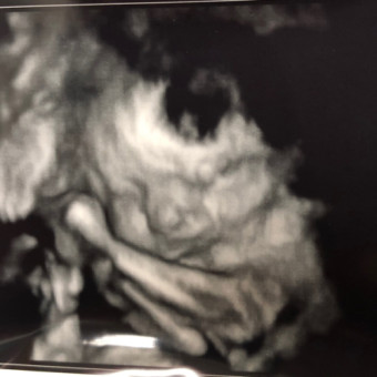 Babylist Registry Photo.