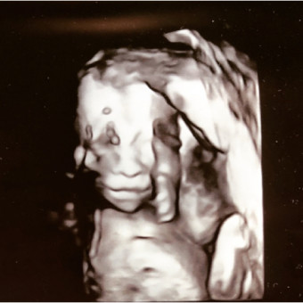 Babylist Registry Photo.