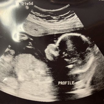 Babylist Registry Photo.