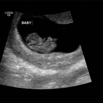 Babylist Registry Photo.