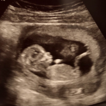 Babylist Registry Photo.
