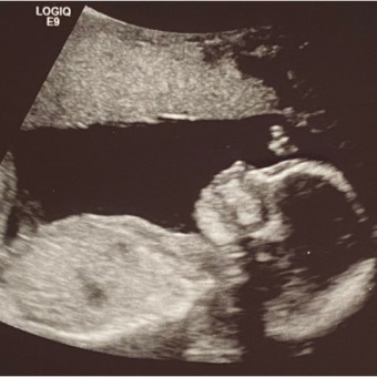 Babylist Registry Photo.
