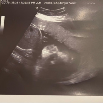 Babylist Registry Photo.