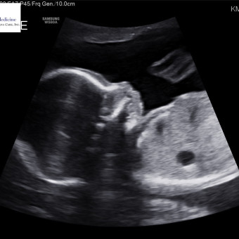 Babylist Registry Photo.