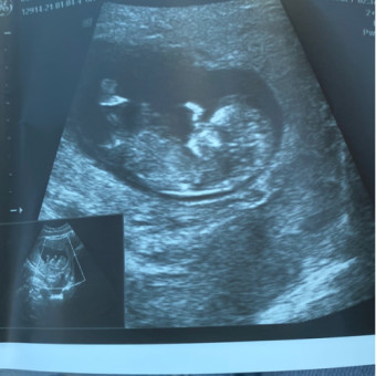 Babylist Registry Photo.