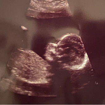Babylist Registry Photo.