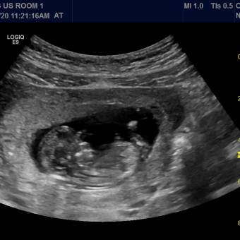 Babylist Registry Photo.