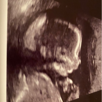 Babylist Registry Photo.