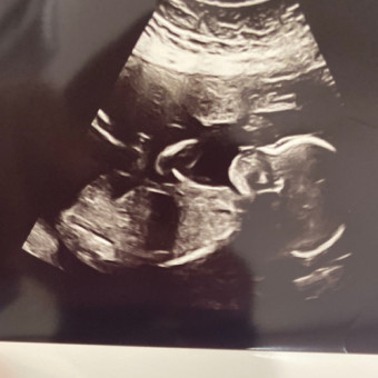 Babylist Registry Photo.