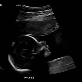 Babylist Registry Photo.