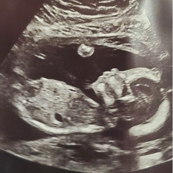 Babylist Registry Photo.