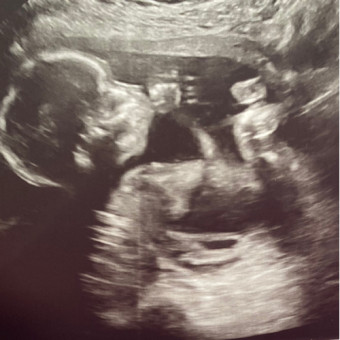 Babylist Registry Photo.