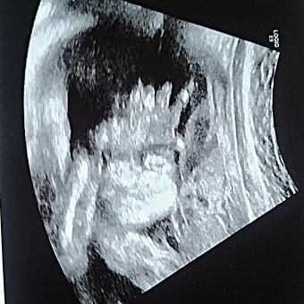 Babylist Registry Photo.