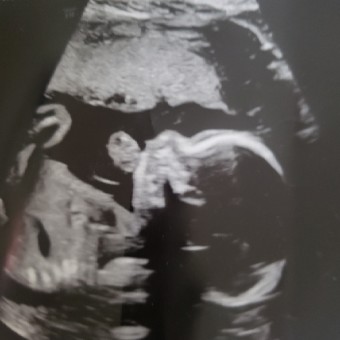 Babylist Registry Photo.