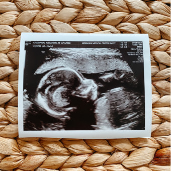 Babylist Registry Photo.