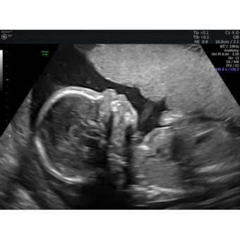 Babylist Registry Photo.