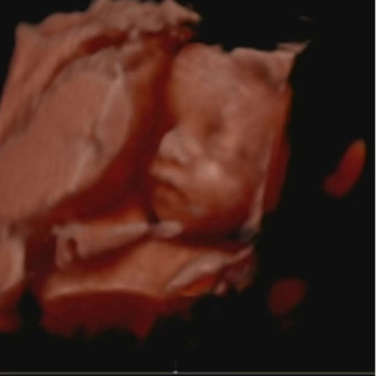 Babylist Registry Photo.