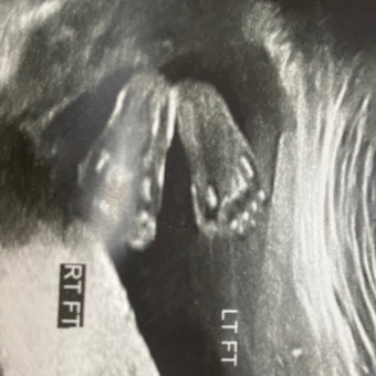 Babylist Registry Photo.