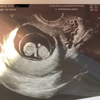 Babylist Registry Photo.