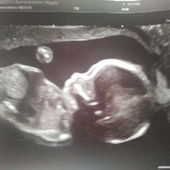 Babylist Registry Photo.
