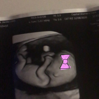 Babylist Registry Photo.