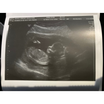 Babylist Registry Photo.