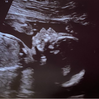 Babylist Registry Photo.