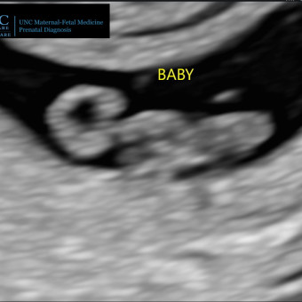 Babylist Registry Photo.