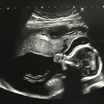 Babylist Registry Photo.