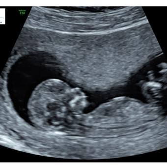 Babylist Registry Photo.