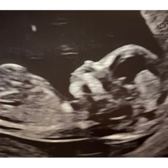 Babylist Registry Photo.