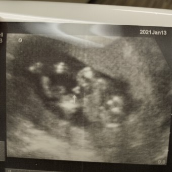 Babylist Registry Photo.