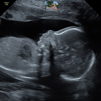 Babylist Registry Photo.
