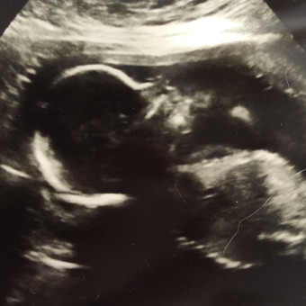 Babylist Registry Photo.