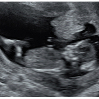 Babylist Registry Photo.