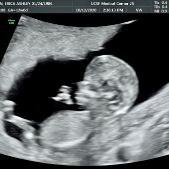 Babylist Registry Photo.