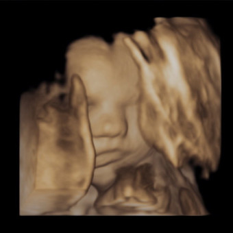 Babylist Registry Photo.
