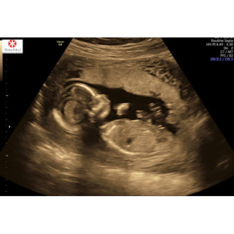 Babylist Registry Photo.