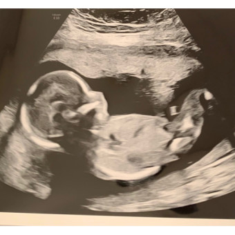 Babylist Registry Photo.