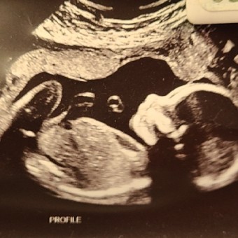 Babylist Registry Photo.