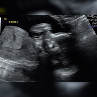Babylist Registry Photo.