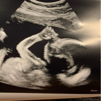 Babylist Registry Photo.