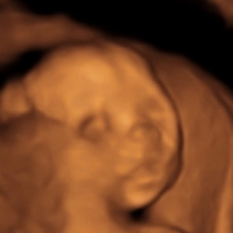 Babylist Registry Photo.